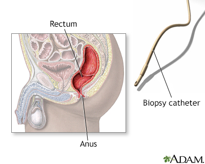Anus blood from seems remarkable Anus blood from opinion you