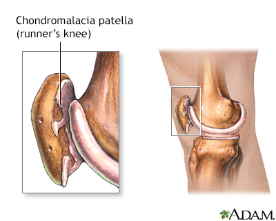 patella definition