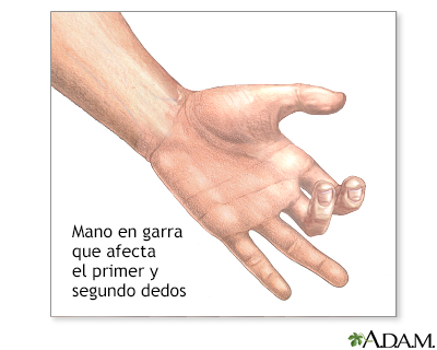 Definicion de manos